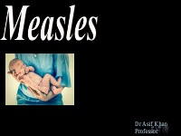 MEASLES EPIDEMIOLOGY.pdf